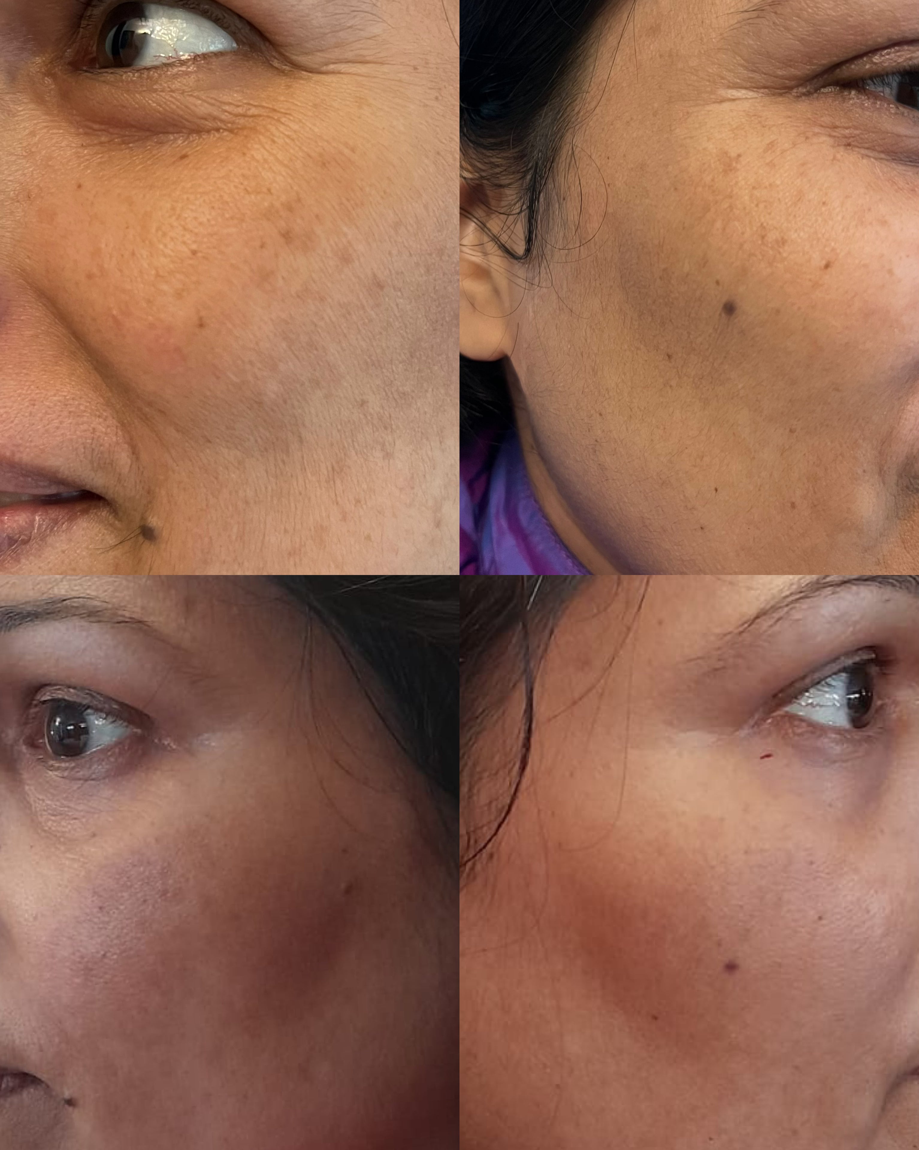 House Of Beauty India Acne Treatments & Kits Pigmentation Serum (30ml) Face Yoga gym Vibhuti Arora facegym Jade roller Guasha skingym Guasha Teacher Training Learn Yoga certified FaceTools Make up Anti ageing Pigmentation Serum (30ml)