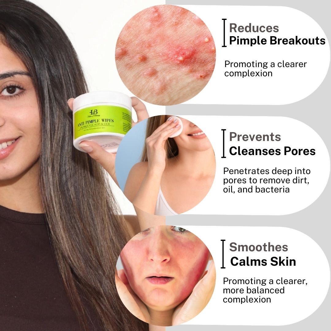 Anti-Pimple Widpes Cream by House of beauty India