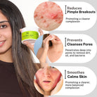 Anti-Pimple Widpes Cream by House of beauty India