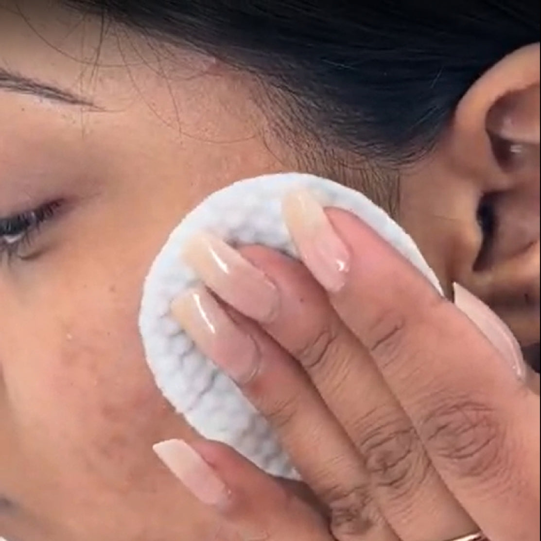 Copy - Model using Anti Pimple Wipes - Old Product Image