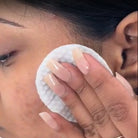 Copy - Model using Anti Pimple Wipes - Old Product Image