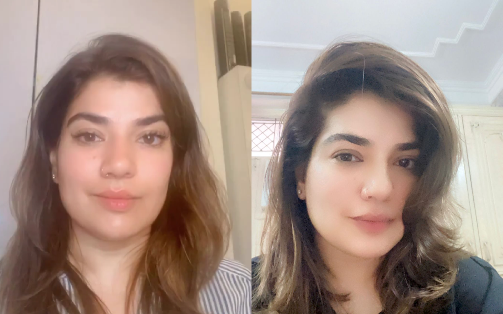 Before and After result image of Bhanu by doing Face yoga