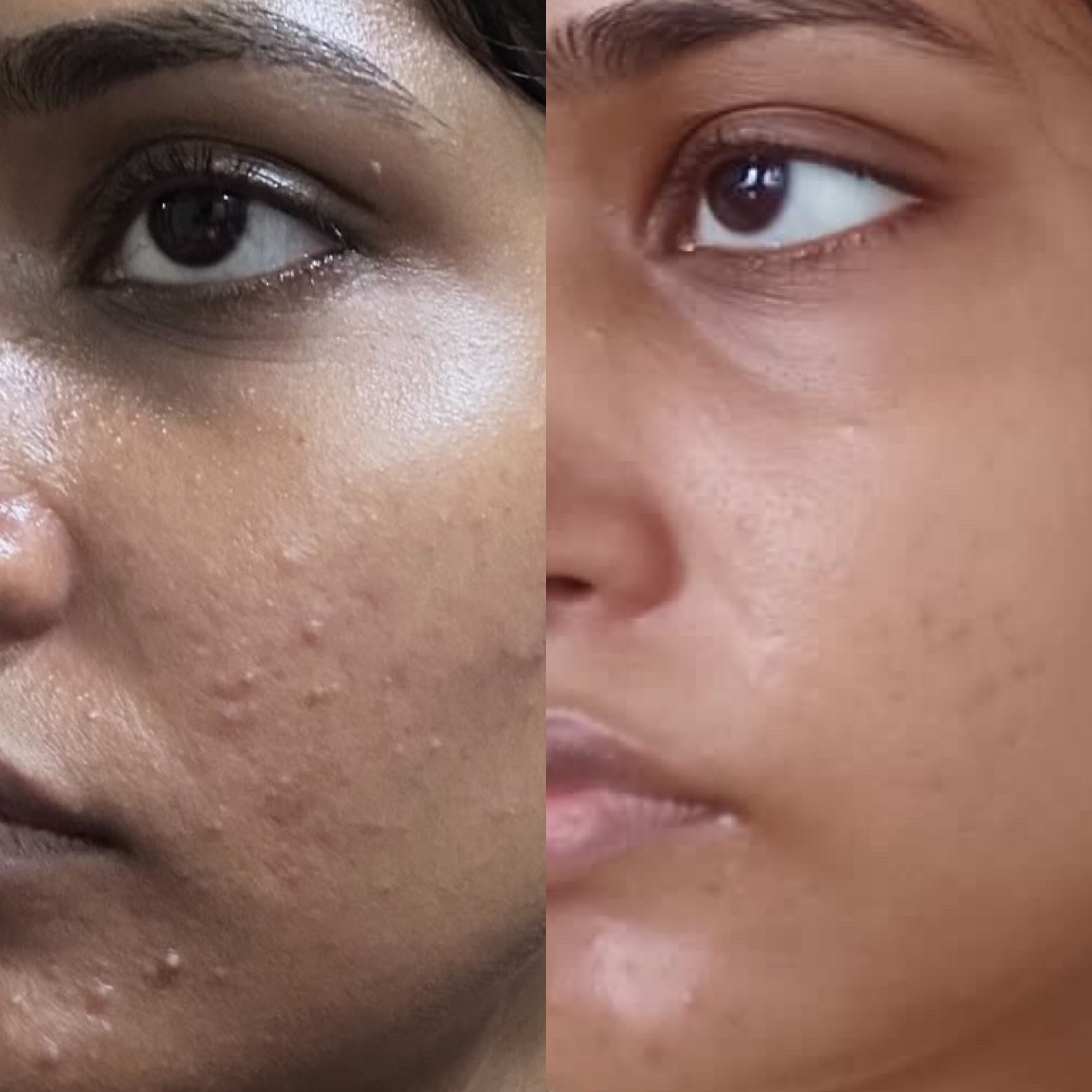 Before and After Image of HOB India - Old Product image