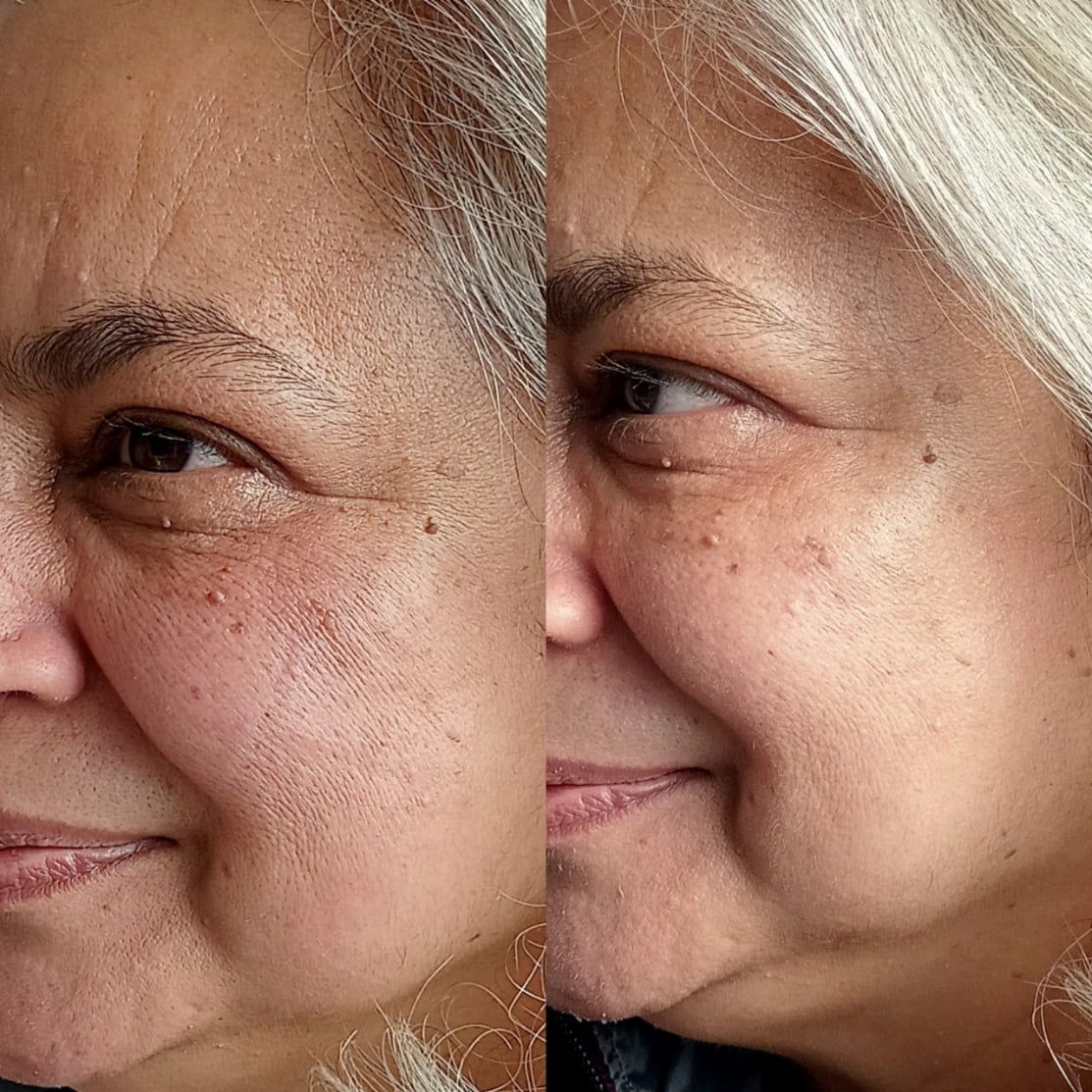 Before and after result of Blue ice globes