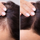 Before and After image of using black seed onion oil - Old product image