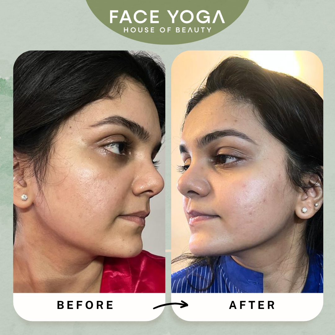Face yoga online program for double chin reduction and jaw toning by Vibhuti Arora House of Beauty
