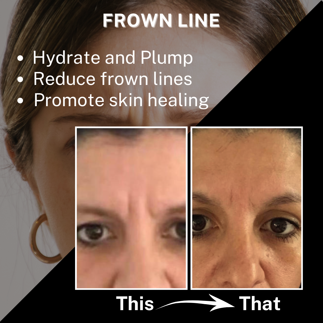 Frown Patches product image with key benefits listed: helps plump skin, brightens dry and dull skin, instantly reduces fine lines, and instantly reduces 11 lines. The packaging and patch tray are shown on a clean white background.