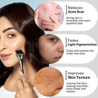 House Of Beauty India Face Tools 0.5mm Derma Roller Face Yoga gym Vibhuti Arora facegym Jade roller Guasha skingym Guasha Teacher Training Learn Yoga certified FaceTools Make up Anti ageing 0.5mm Derma Roller