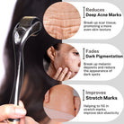 House Of Beauty India Face Tools 0.75mm Derma Roller Face Yoga gym Vibhuti Arora facegym Jade roller Guasha skingym Guasha Teacher Training Learn Yoga certified FaceTools Make up Anti ageing 0.75mm Derma Roller
