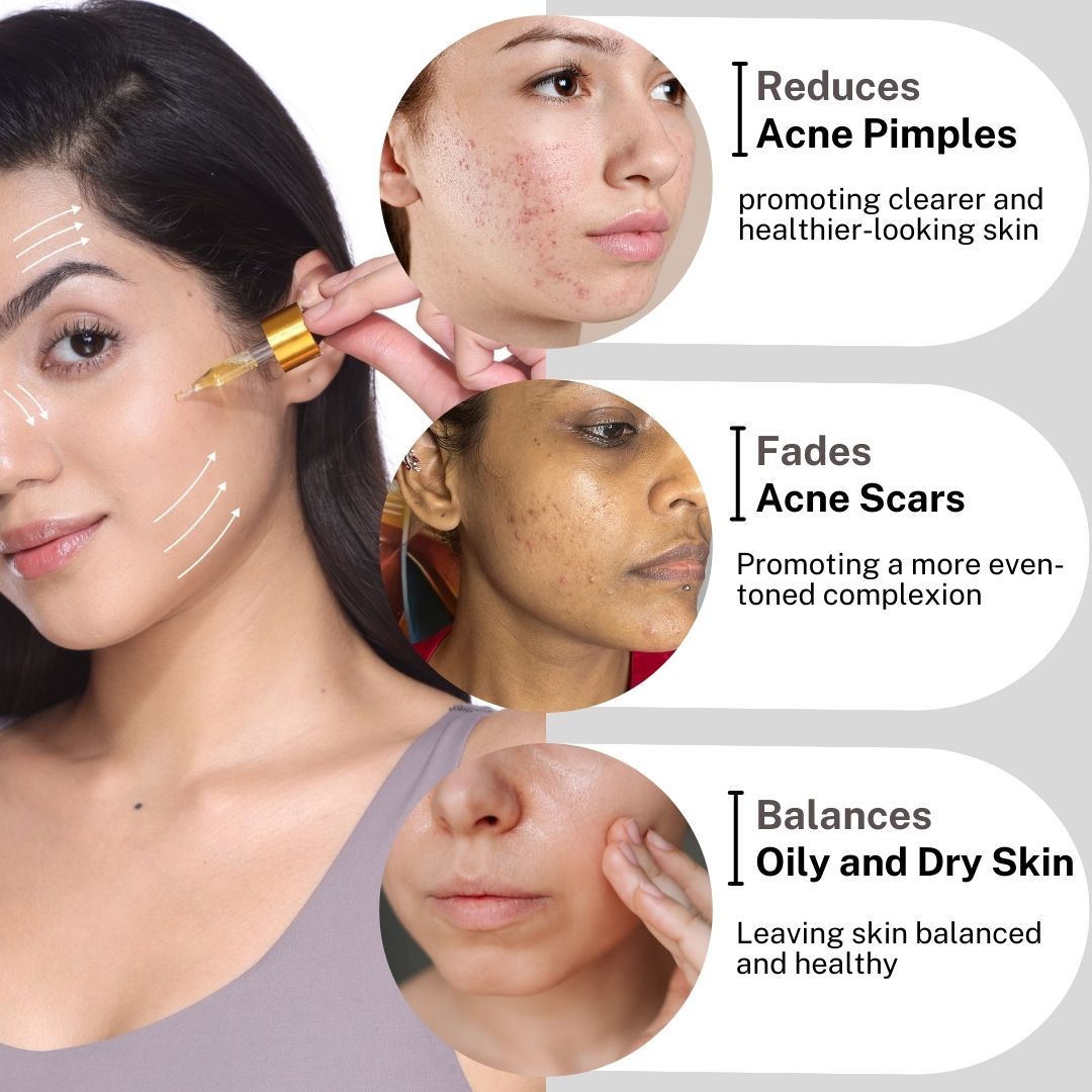 House of Beauty India Superfood Acne Oil Serum (30ml) a potent blend of tea tree oil, avocado oil, and vitamin E for clear, smooth, and acne free skin. Deep cleansing, anti-inflammatory, and antibacterial properties target acne at its root.