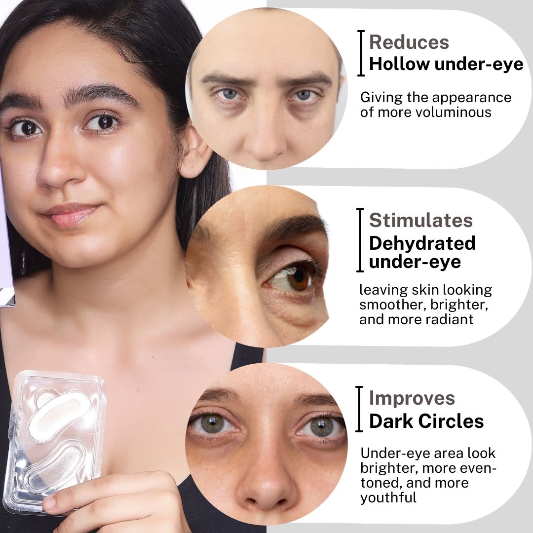 Face yoga under eye anti aging eye patches Microneedling under-eye patches for hydration and dark circle correction, similar to SiO Beauty and Peace Out Skincare. Cheaper dupe of 111 skincare, for puffiness reduction, wrinkle and dark circle reduction tools. Filled with hyaluronic acid and collagen peptide for hollow eye plumping at home instead of filler injection. they are a must-have for anyone searching for needle-free filler alternatives korean or K beauty patches.