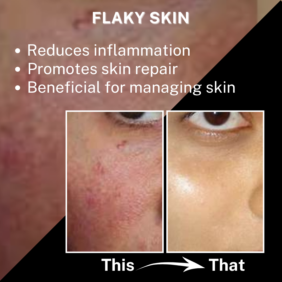 House of Beauty Kumkumadi Gel Cream texture close-up — lightweight saffron-based glow moisturiser.
ayurvedic face cream, natural glow moisturizer, pigmentation repair, saffron gel cream