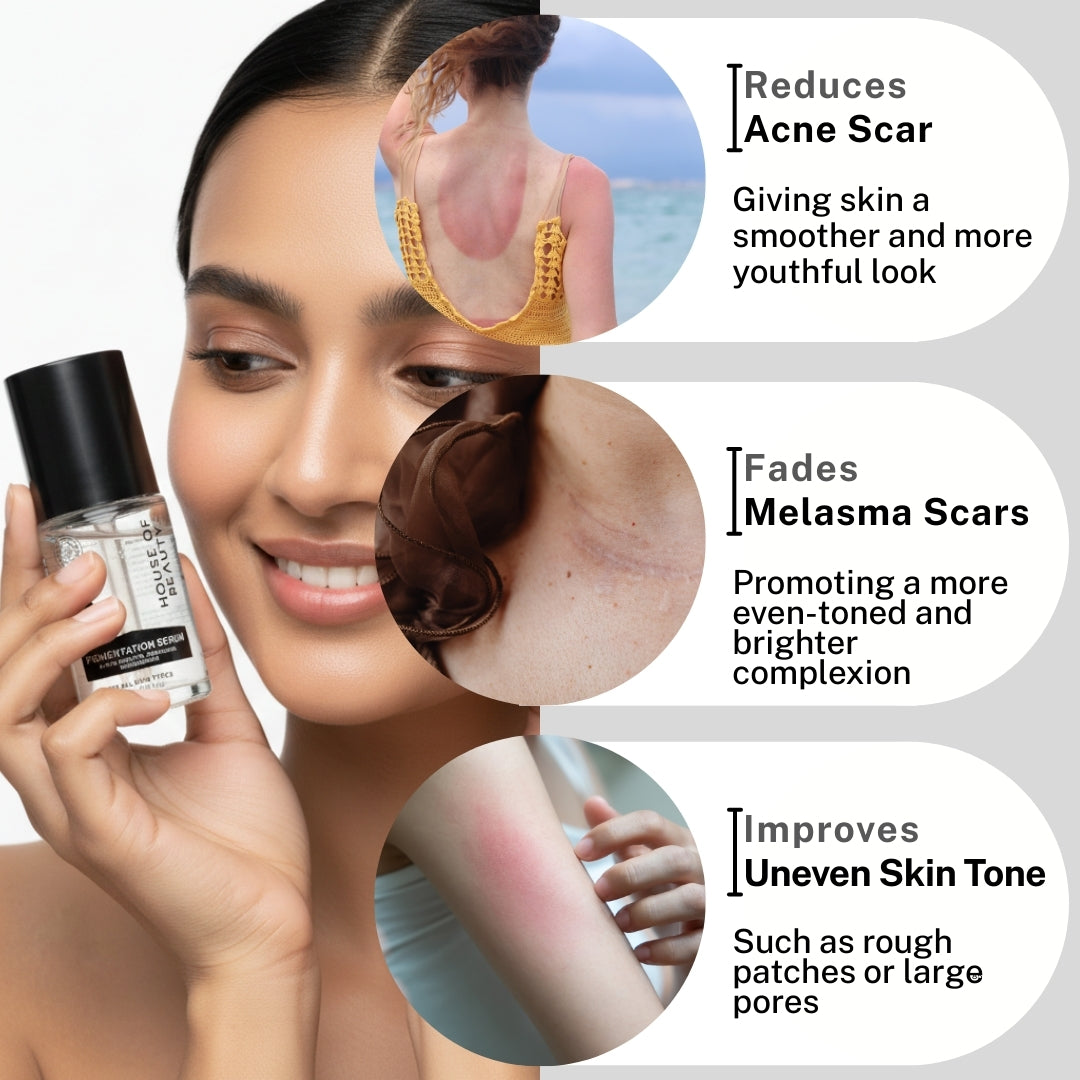 “A woman holding Pigmentation Serum with circular visuals highlighting concerns like acne scars, melasma marks, and uneven skin tone, alongside descriptive text.”