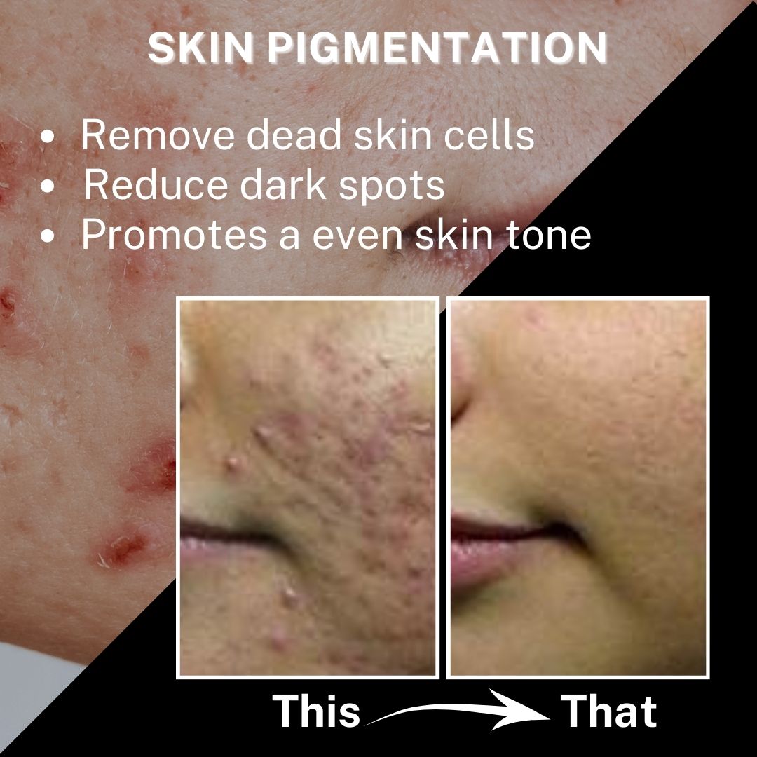 “Before-and-after comparison of facial skin showing pigmentation and dark spots on one side and a more even skin tone on the other, with text about skin pigmentation benefits.”