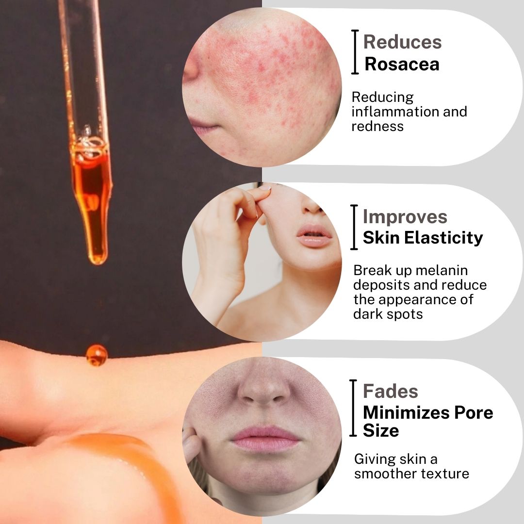 A high-contrast shot of the gold 30ml Rosacea Soothing Oil bottle standing next to its black packaging. The vertical text on the right side of the image reads "ROSACEA SOOTHING OIL" in bold white letters.