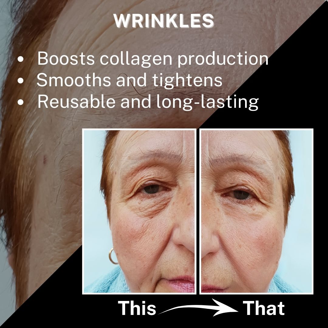 Wrinkles Image Before and After results showing 1