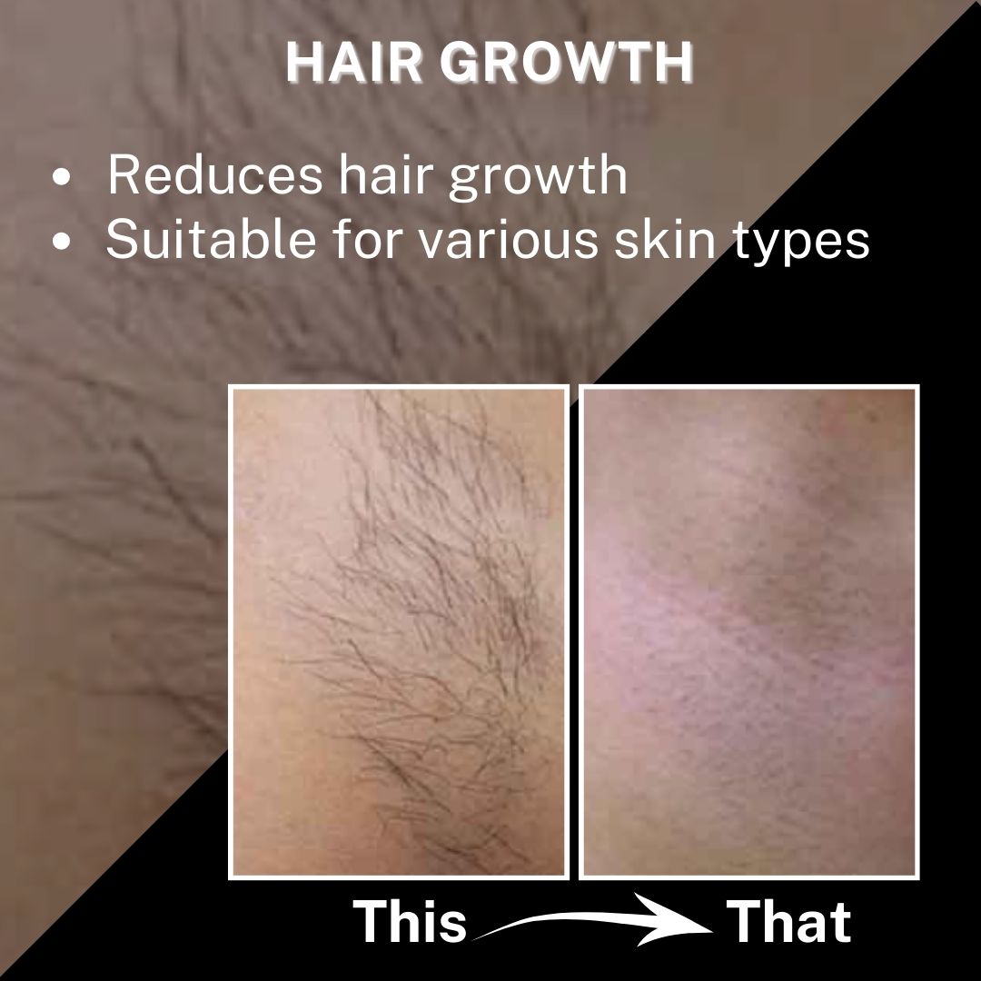 Hair Growth Results After Using Silktronic hair Removal Pro