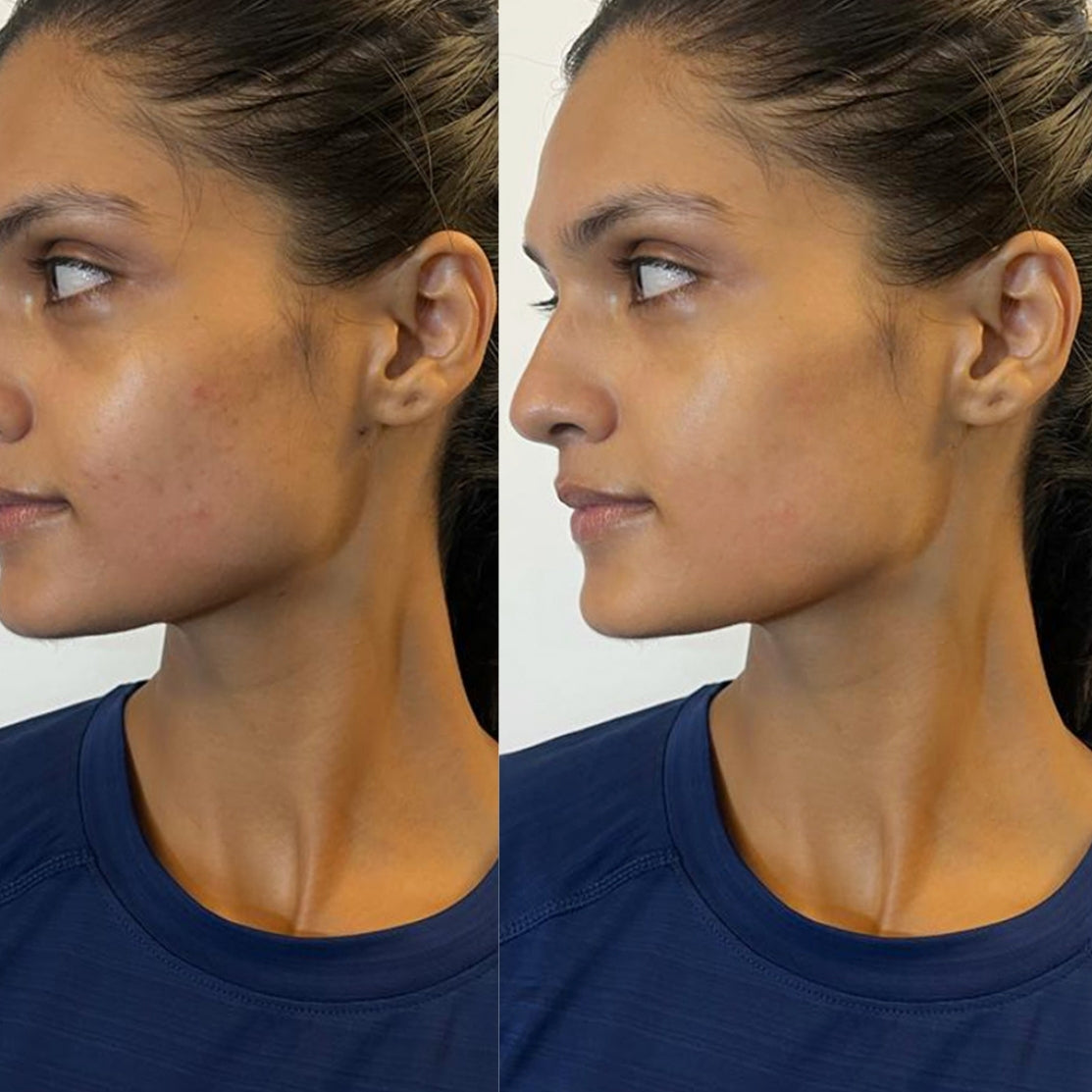 before and after face