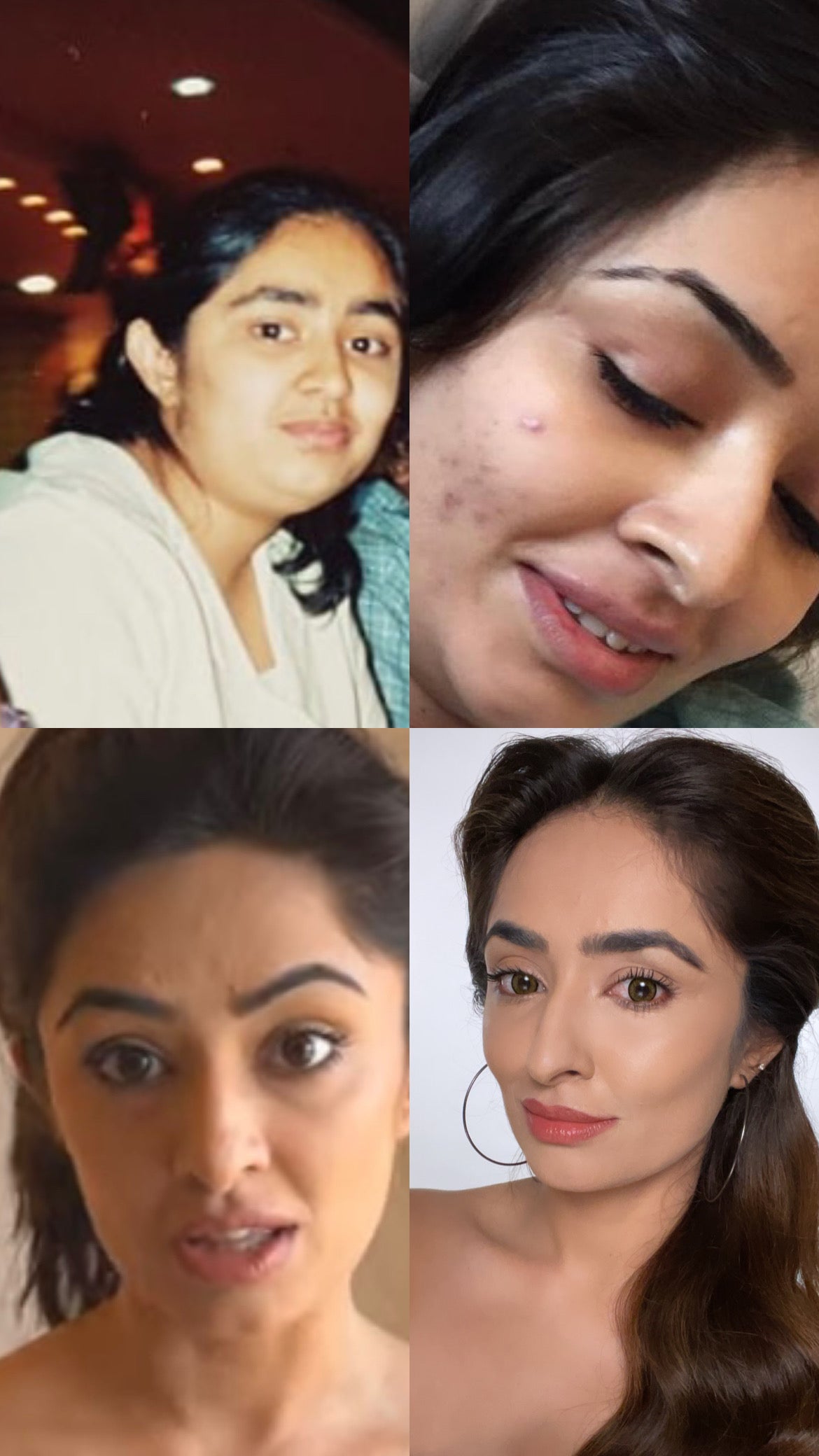 Vibhuti Arora Journey with Face Yoga