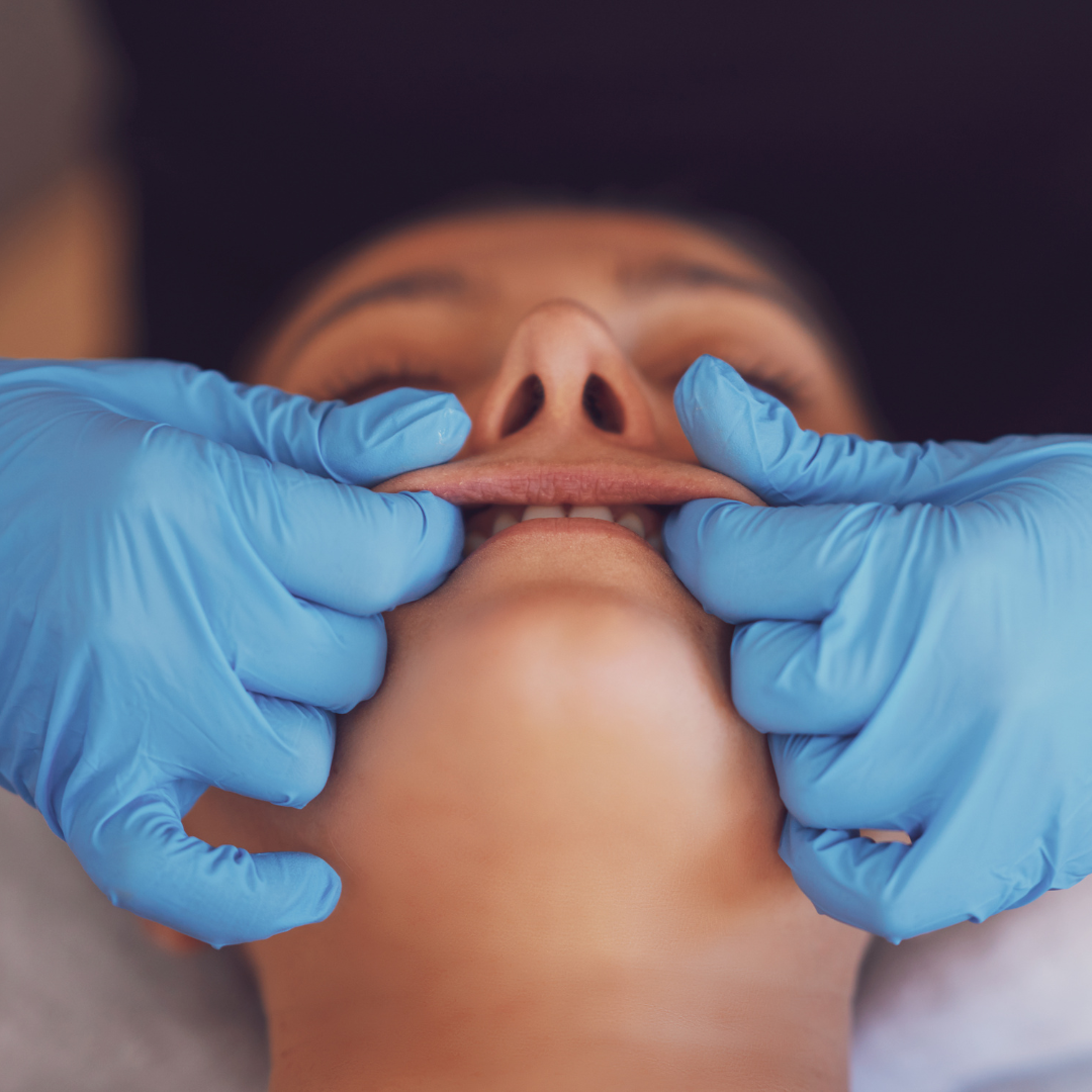 buccal massage image