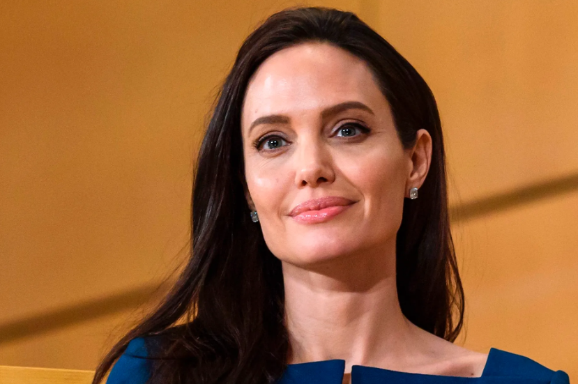 All About Facial Paralysis: Top Celebrities Journey With Bell’s Palsy