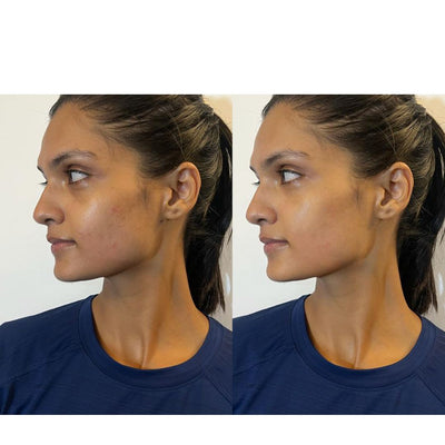 Face Yoga Exercises for Nose