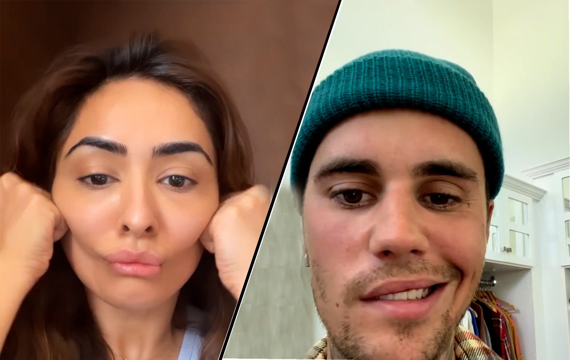 Justin Bieber Diagnosed With Ramsay Hunt Syndrome | What Is It And How Facial Exercises Help In Treatment