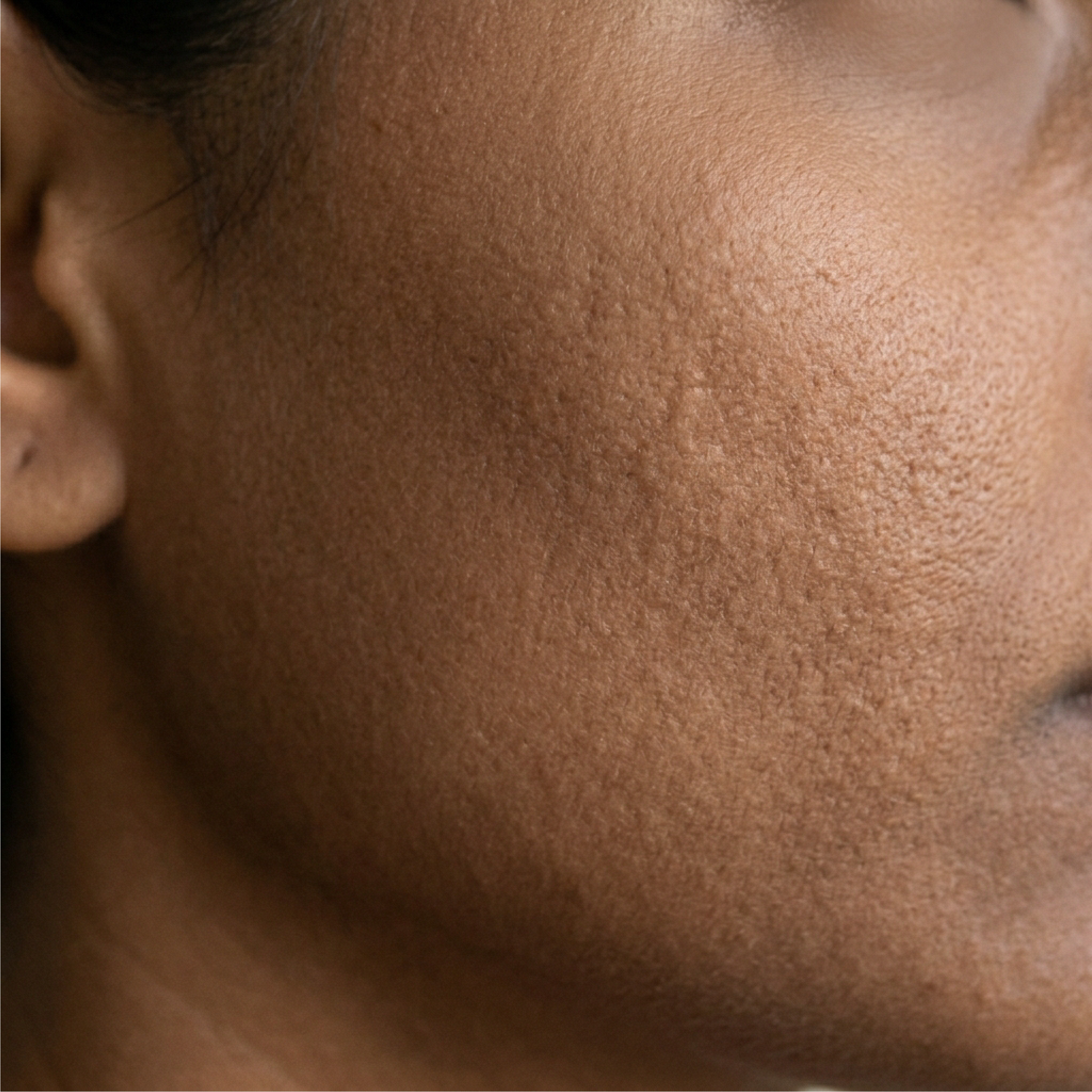 Close-up of textured facial skin with uneven tone and lack of radiance on the cheek area.