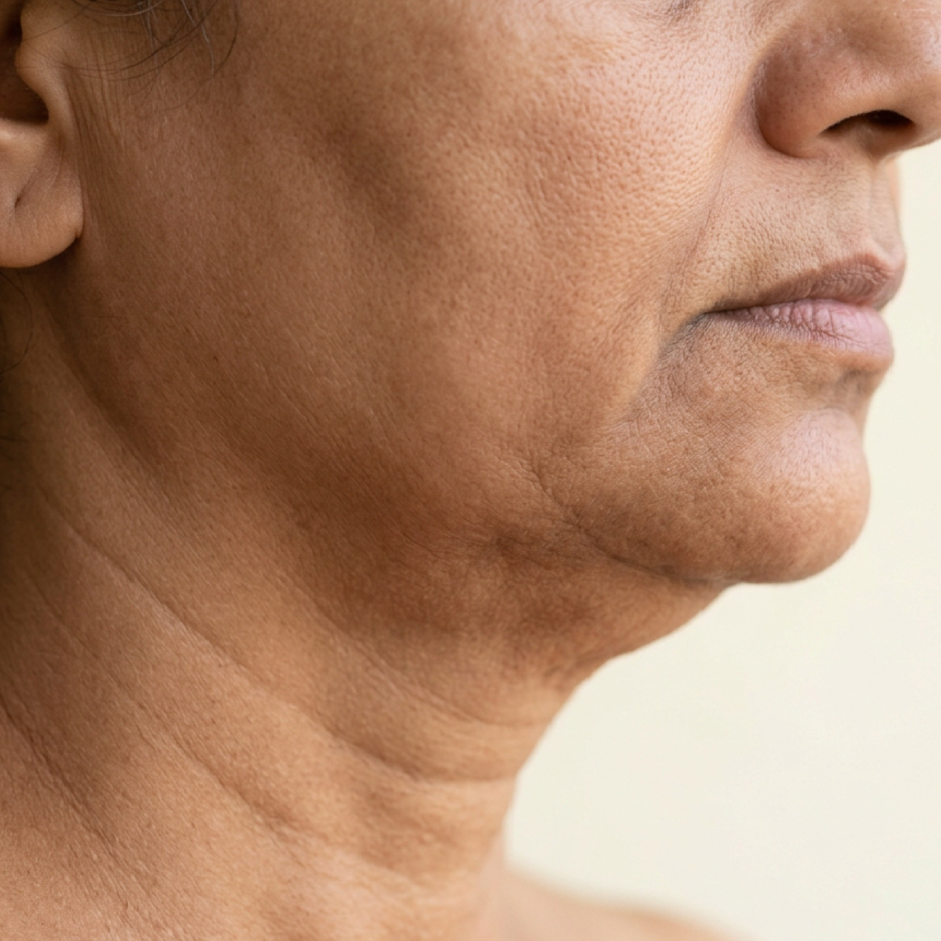 Side profile of a person with loose and sagging skin around the jawline and neck area.