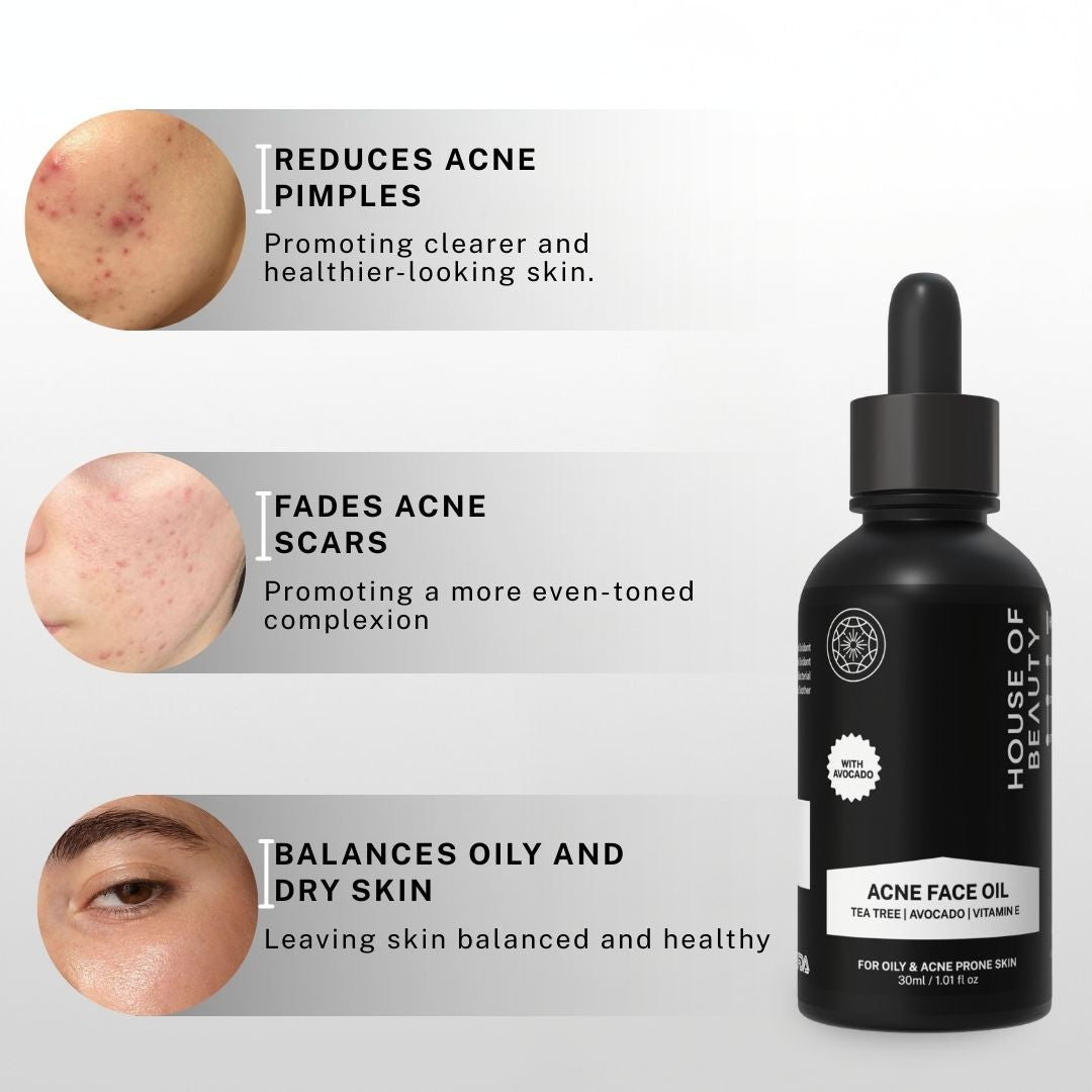 House of Beauty Acne Face Oil helps reduce acne pimples, fade scars, and balance oily and dry skin for a healthier complexion.