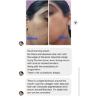 Before and After image of using collagen cream in HOB India - Old Product Image 