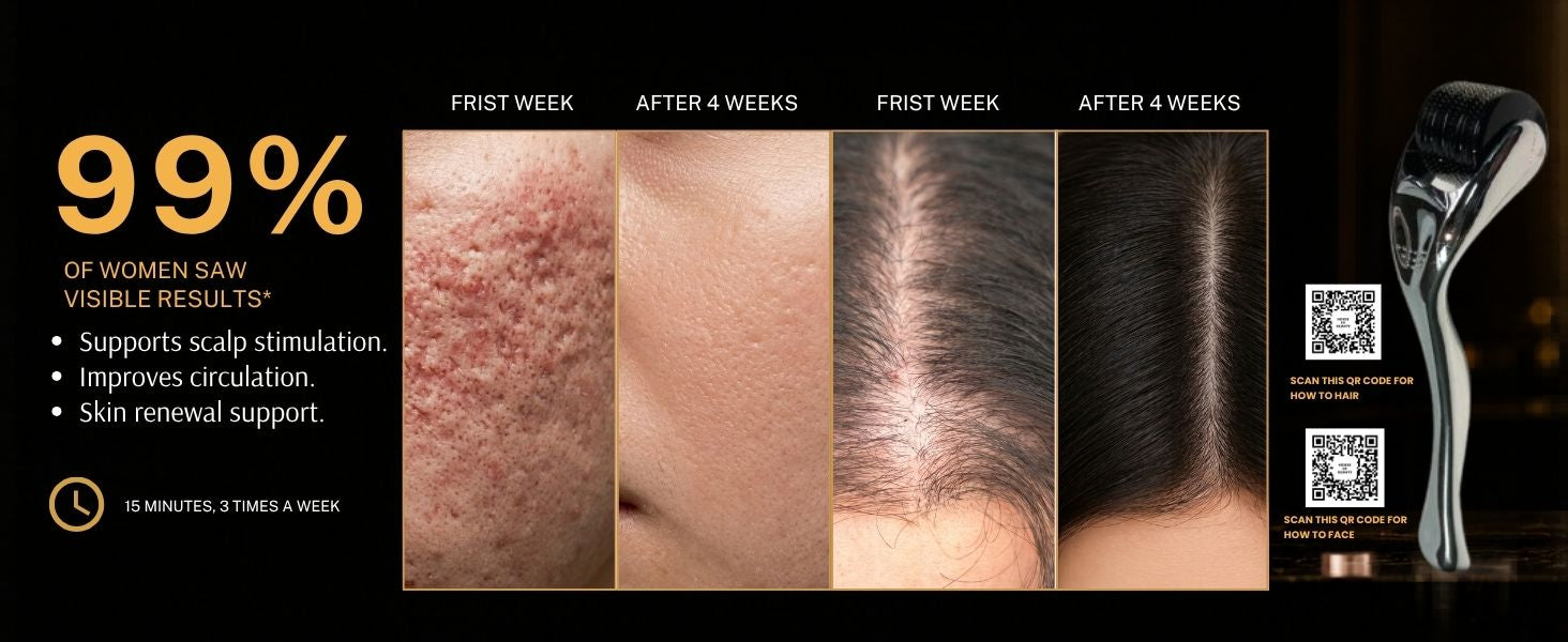 Before-and-after comparison showing improvements in acne scars, skin texture, and scalp appearance after 4 weeks of derma roller use. Features claims of scalp stimulation, improved circulation, skin renewal support, and visible results with regular use for 15 minutes, 3 times a week.