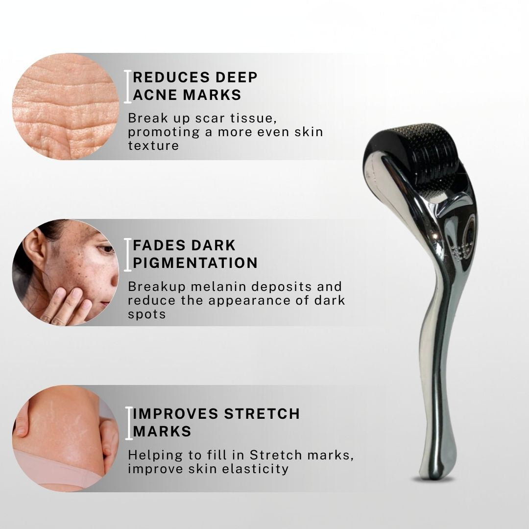 House of Beauty 0.75mm derma roller displayed with visuals describing benefits such as reducing deep acne marks, fading dark pigmentation, and improving stretch marks and skin texture.