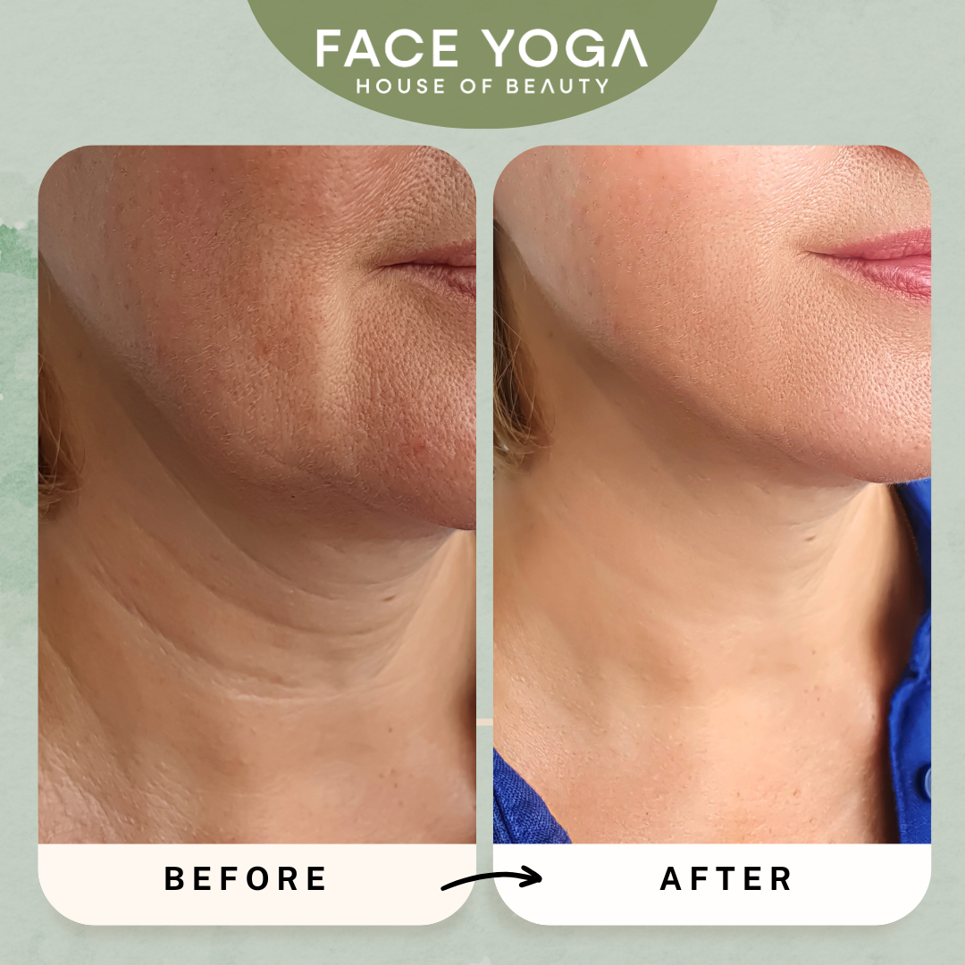Lower Face Workout: Droopy Lips, Jaw Neck Face Yoga by Vibhuti