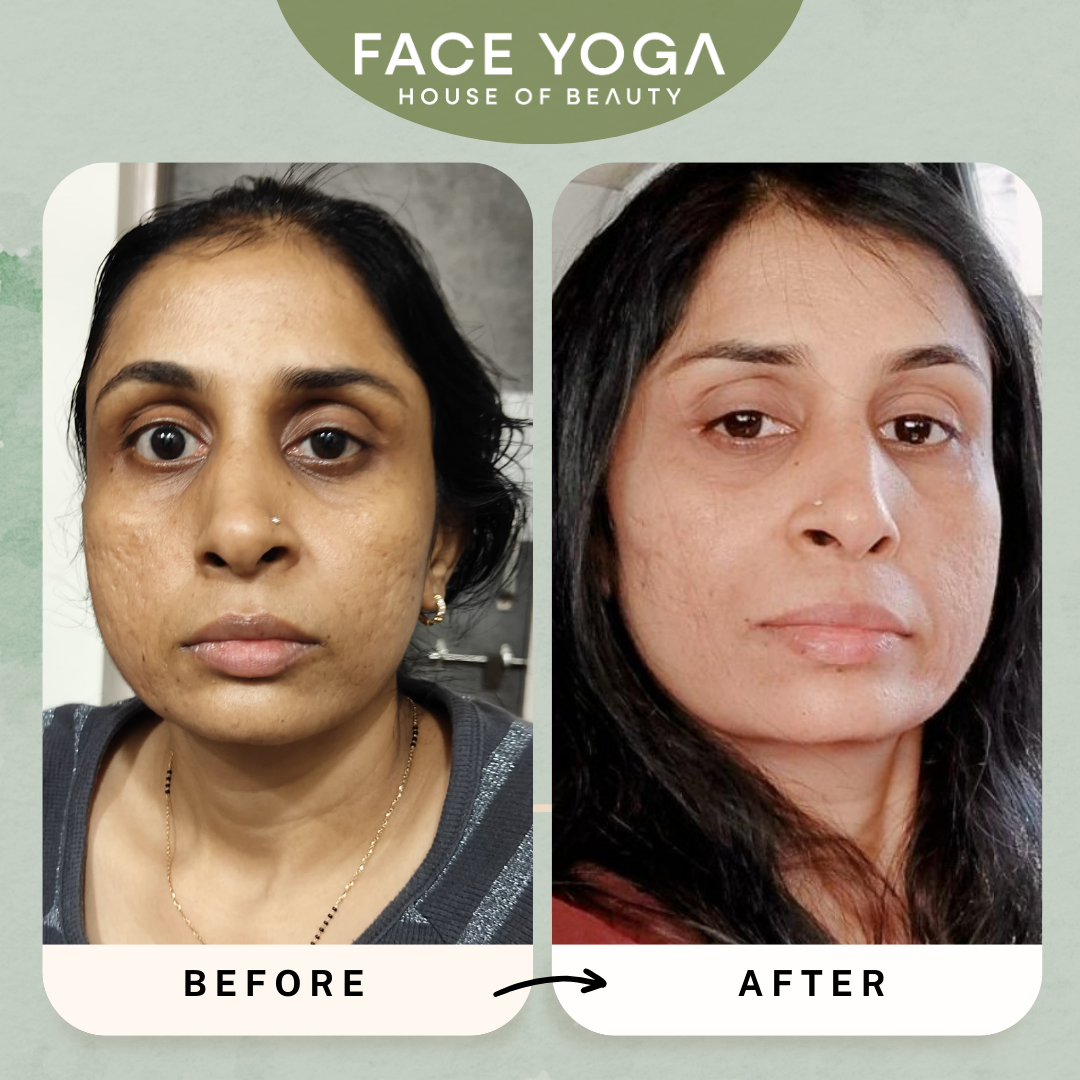 Face Asymmetry correction with Face Yoga by Vibhuti Arora (Pre-recorded)