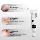 Milia Serum highlighting removal of whiteheads, reduced oil buildup and fading milia marks for smoother, even-toned skin.