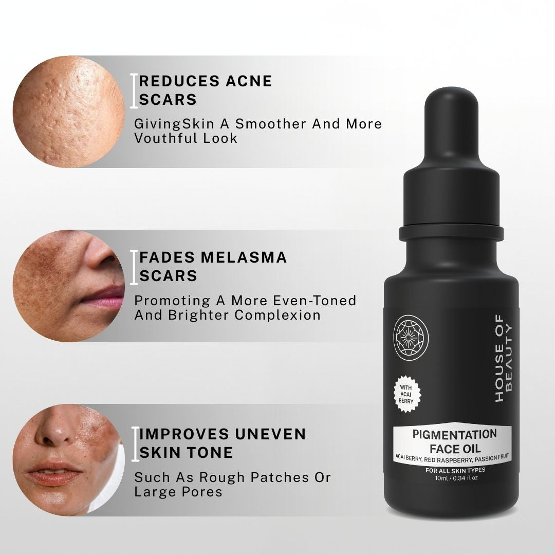 Pigmentation Face Oil benefits showing reduced acne scars, faded melasma marks and improved uneven skin tone.