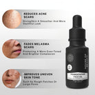 Pigmentation Face Oil benefits showing reduced acne scars, faded melasma marks and improved uneven skin tone.