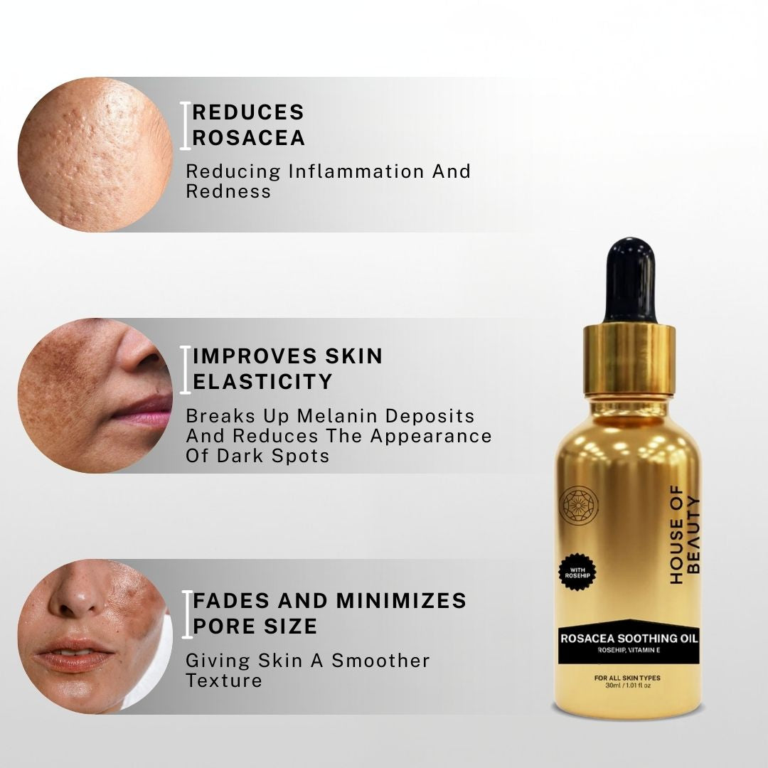House of Beauty Rosacea Soothing Oil helping reduce rosacea inflammation, improve skin elasticity and minimize pores.