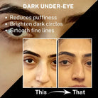 Before-and-After photo comparison showing reduction in dark under-eye circles. Text highlights benefits: Reduces puffiness, Brighten dark circles, and Smooth fine lines.