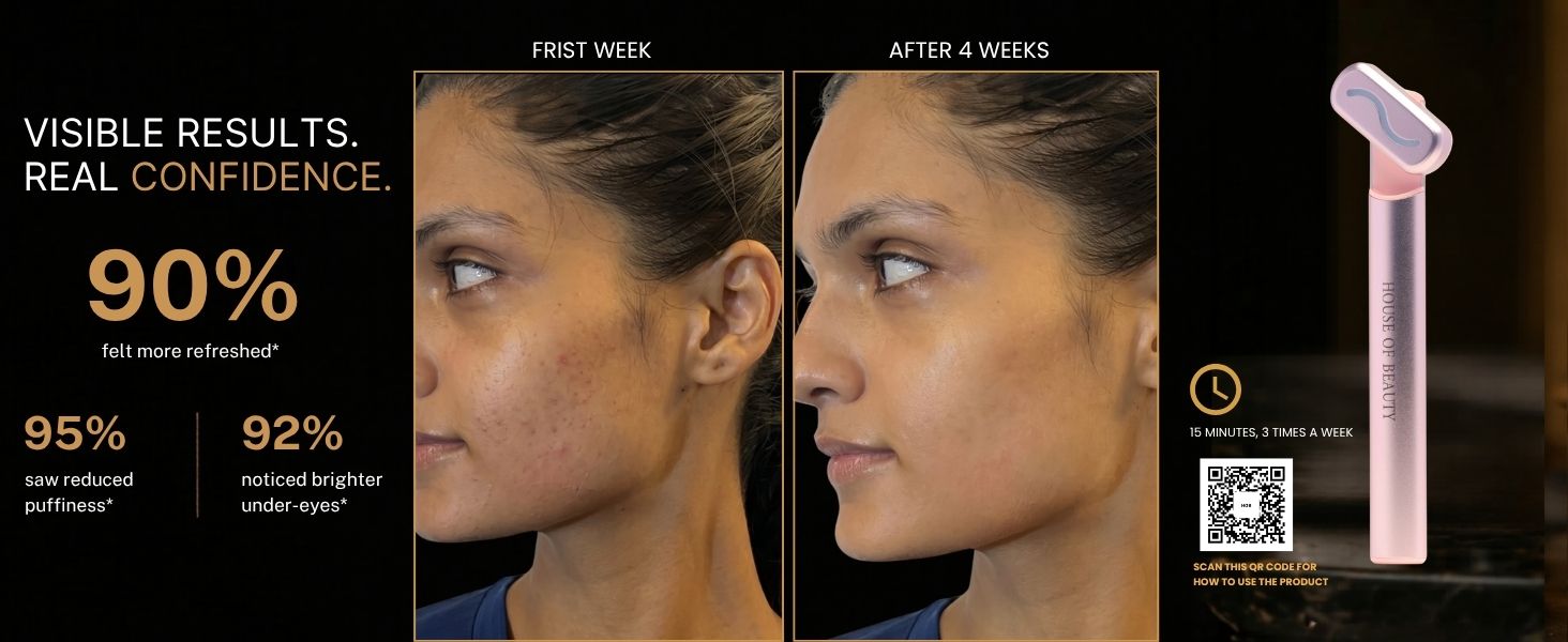 Before and after LED Eye Massager results for reducing puffiness, brightening under-eyes, and improving eye contour appearance